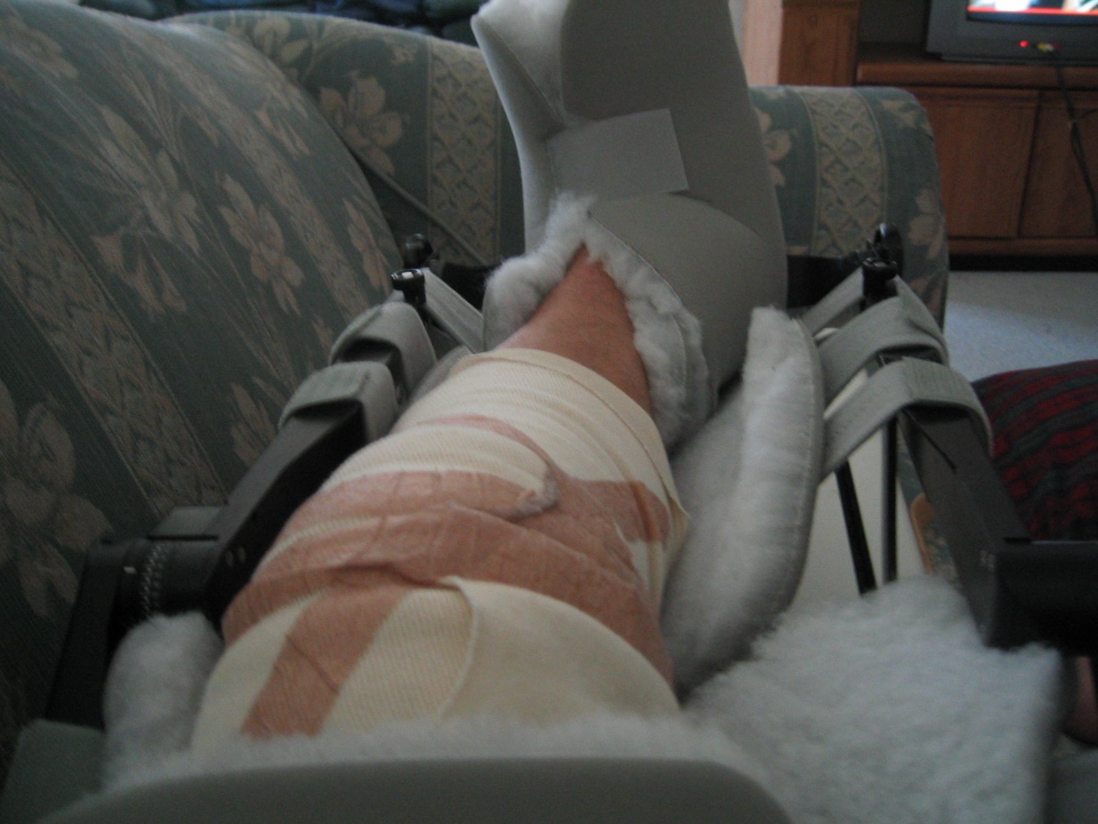 Knee Surgery Recovery